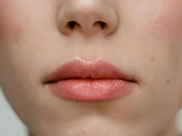 Lip Hydration Booster