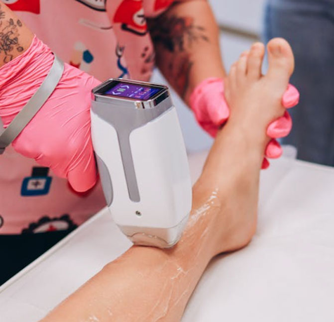 laser hair removal 1
